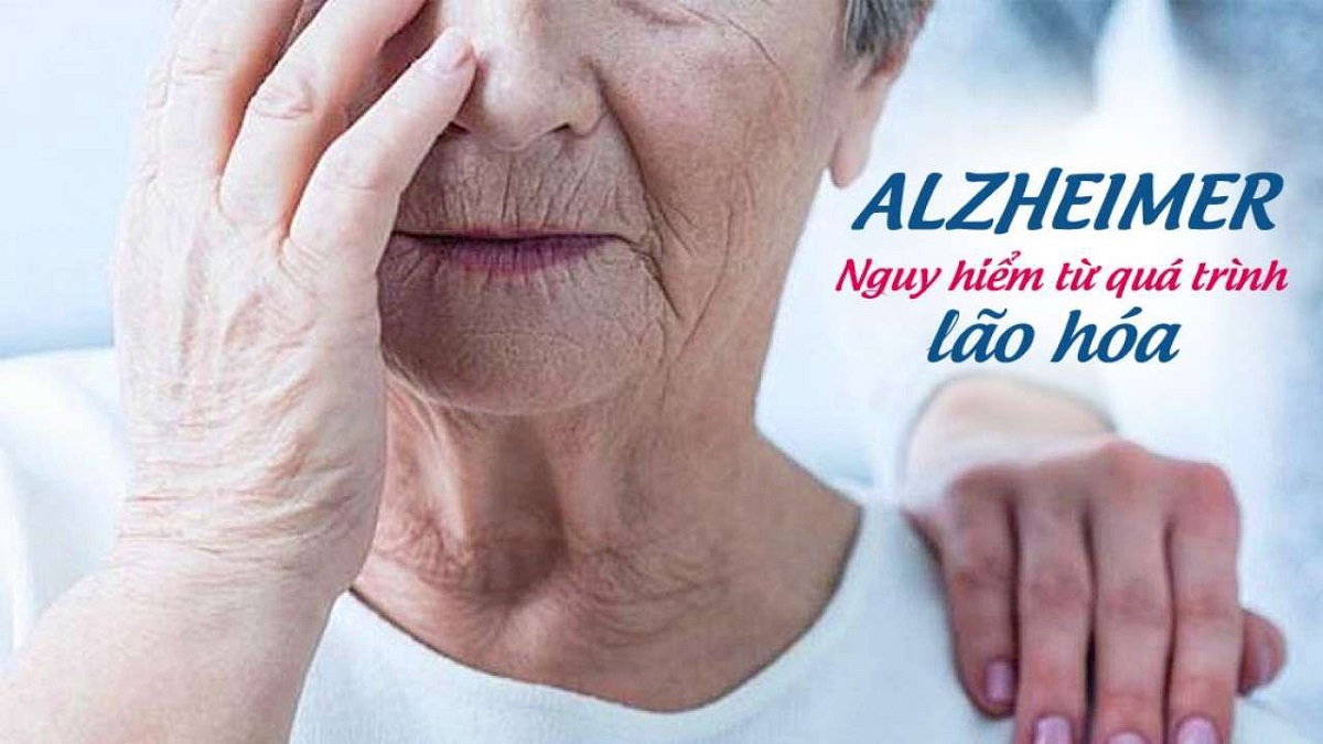 Nước ion kiềm có chữa được bệnh Alzheimer không?