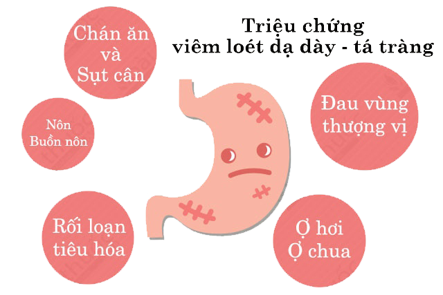 Điều trị đau bao tử tại nhà bằng cách nào? - Thế Giới Điện Giải